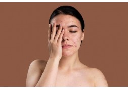 ¿Cómo proteger la piel frente al picor y la irritación?